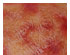 209972_1 thumbnail image
